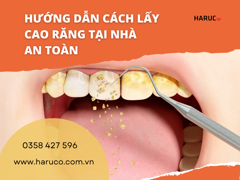 Hướng dẫn cách lấy cao răng tại nhà an toàn