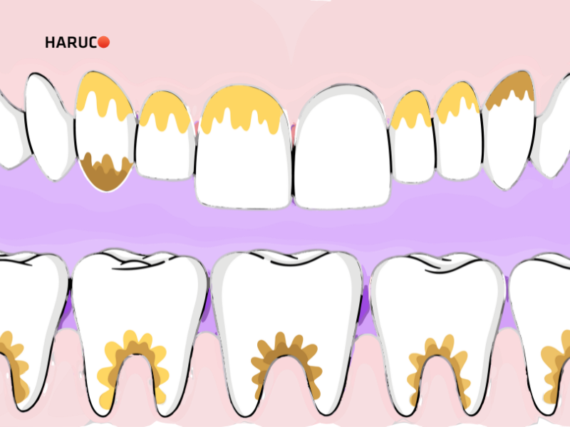 may-lat-cao-rang-haruco