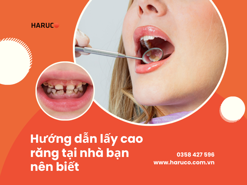 Hướng dẫn lấy cao răng tại nhà bạn nên biết
