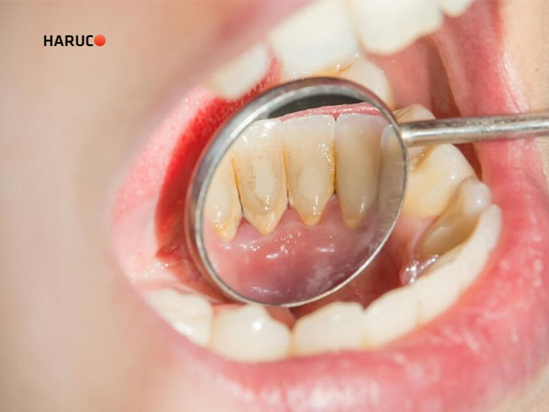 may-lay-cao-rang-haruco