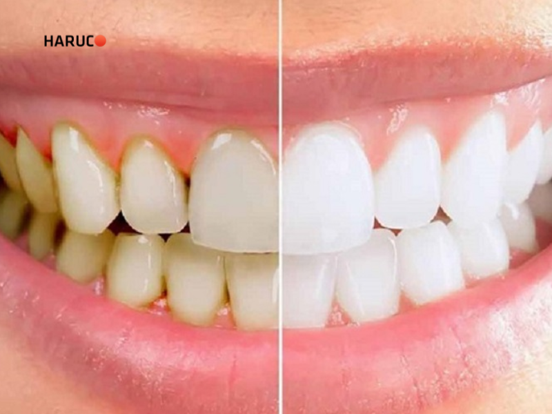 may-lay-cao-rang-haruco