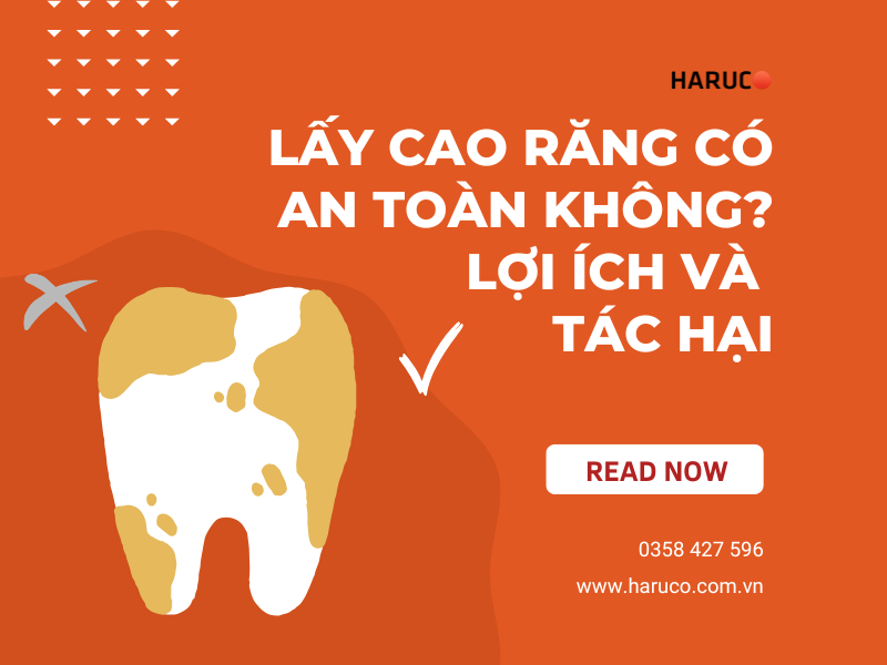 Lấy cao răng có an toàn không? Lợi ích và tác hại