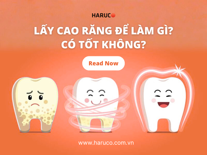Lấy cao răng để làm gì? Có tốt không?