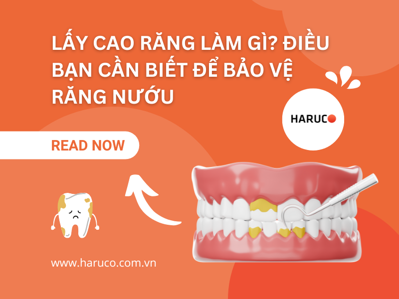 Lấy cao răng làm gì? Điều bạn cần biết để bảo vệ răng nướu