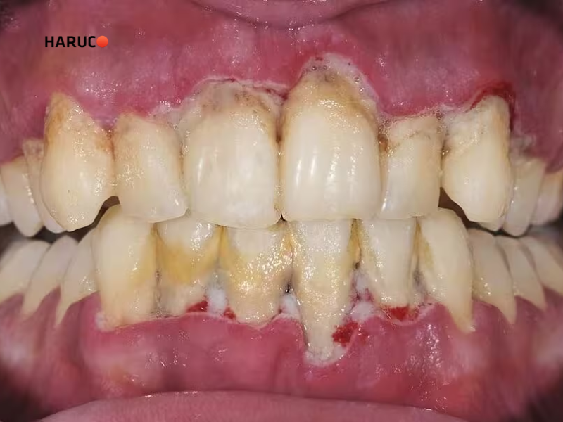 may-lay-cao-rang-haruco