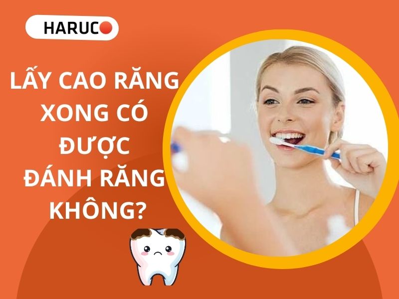 Lấy cao răng xong có được đánh răng không?