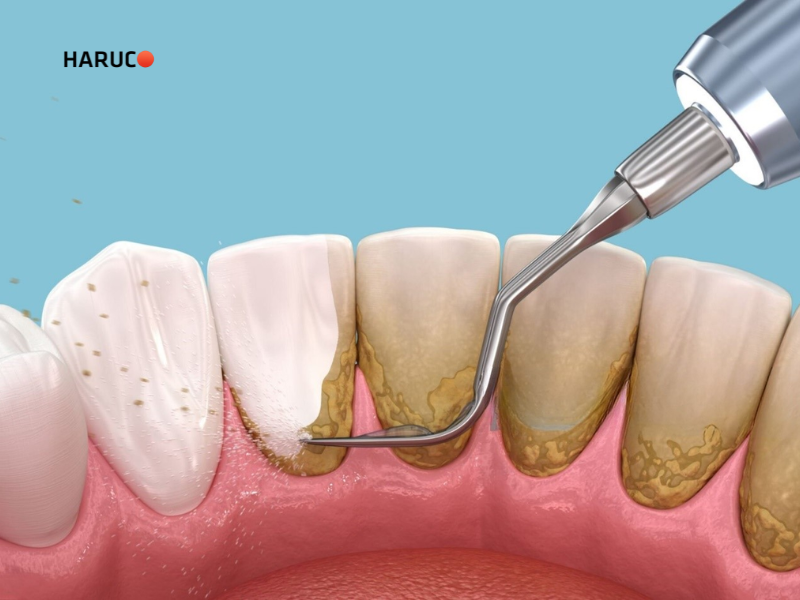 may-lay-cao-rang-haruco