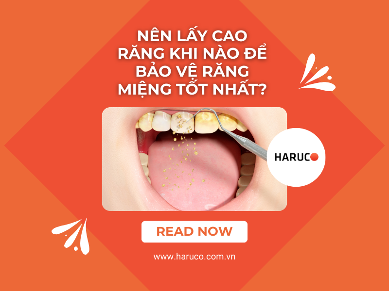 Nên lấy cao răng khi nào để bảo vệ răng miệng tốt nhất?