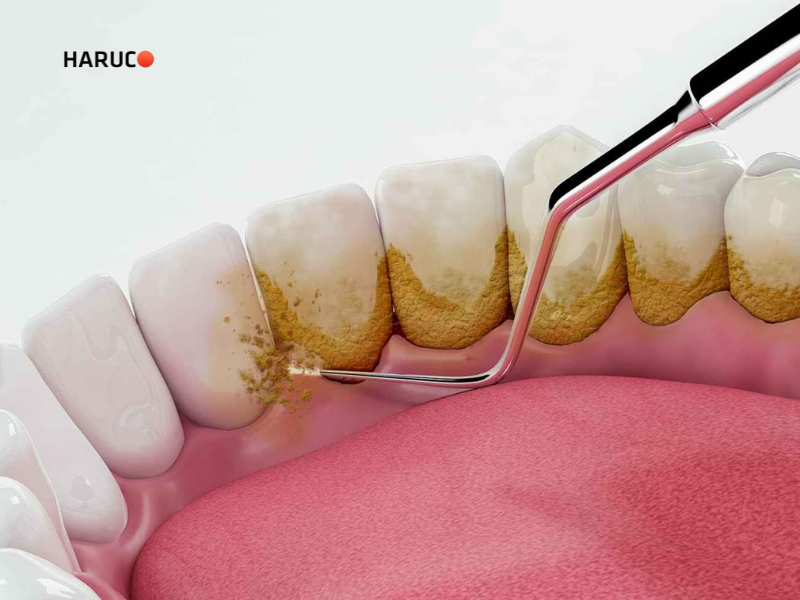 may-lay-cao-rang-haruco