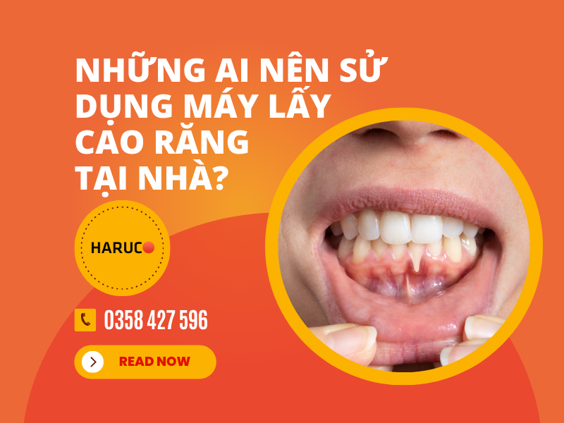 Những ai nên sử dụng máy lấy cao răng tại nhà?