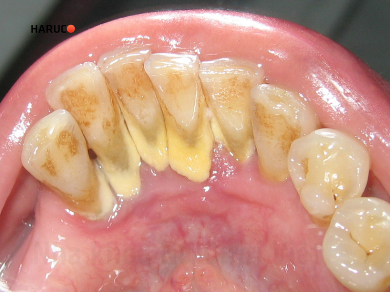 may-lay-cao-rang-haruco