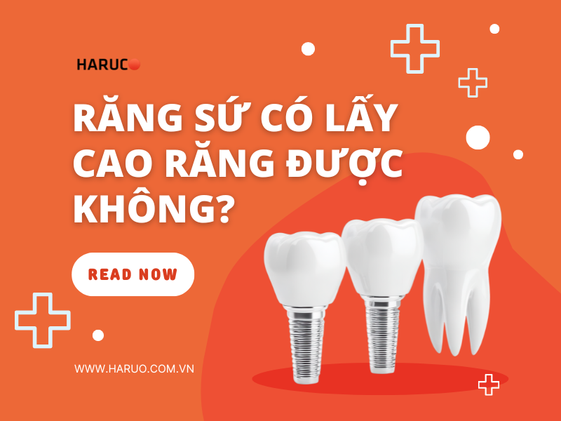 Răng sứ có lấy cao răng được không?