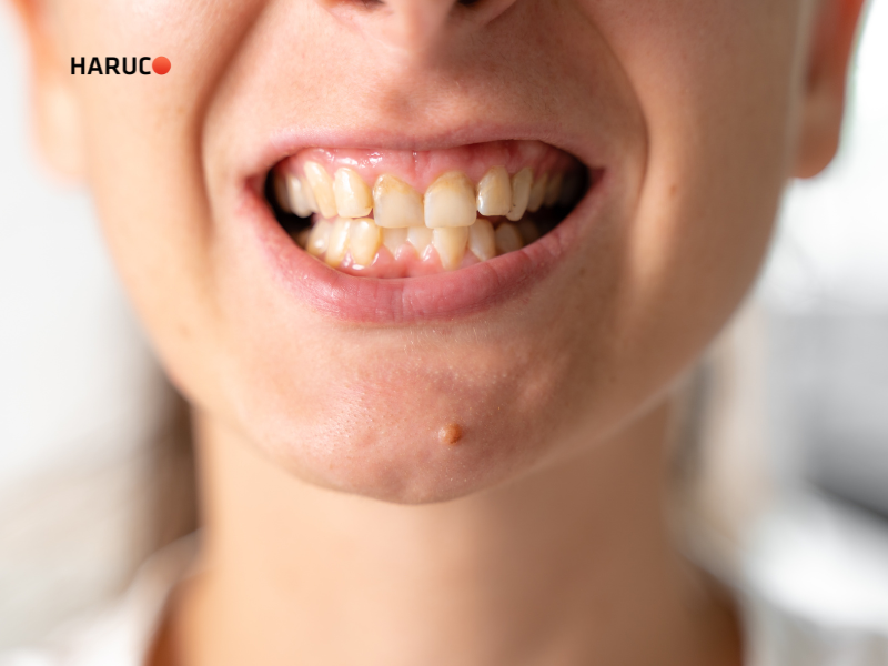 may-lay-cao-rang-haruco