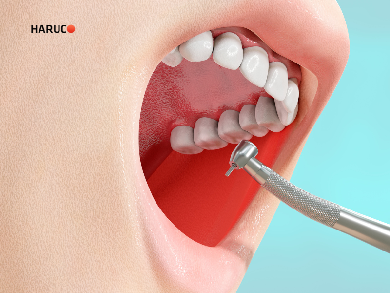 may-lay-cao-rang-haruco