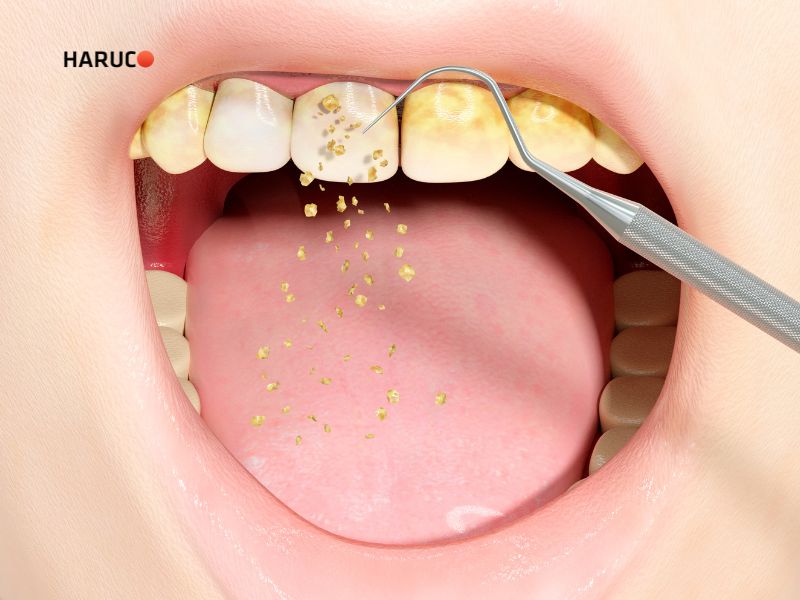 may-lay-cao-rang-haruco