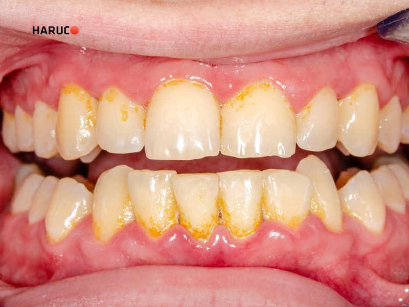 may-lay-cao-rang-haruco