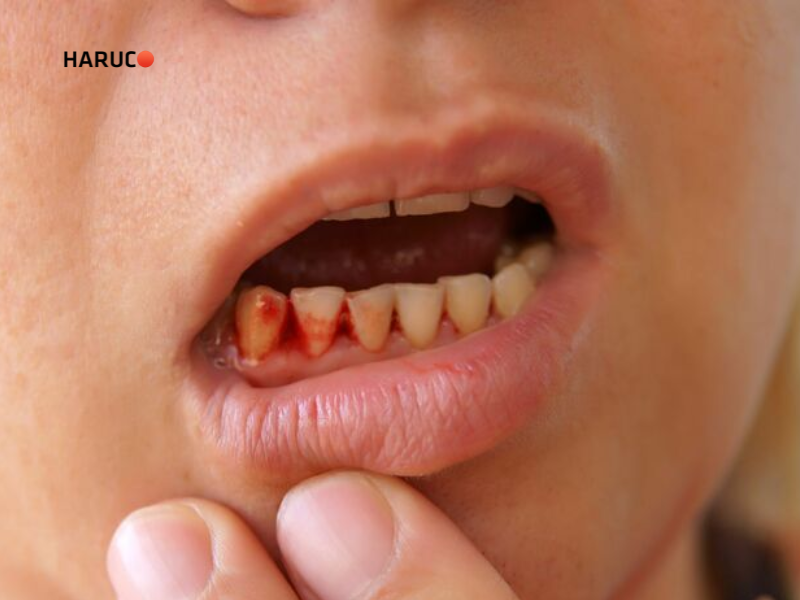 may-lay-cao-rang-haruco