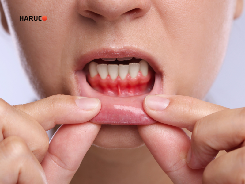 may-lay-cao-rang-haruco