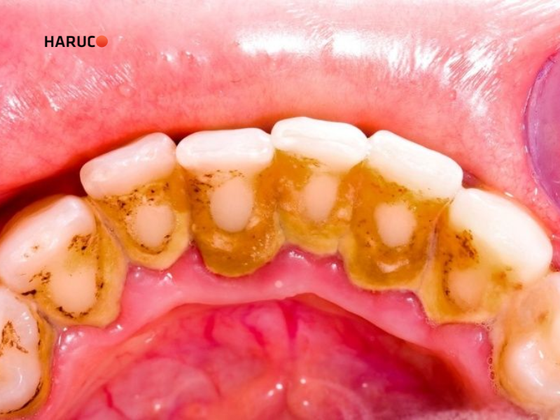 may-lay-cao-rang-haruco