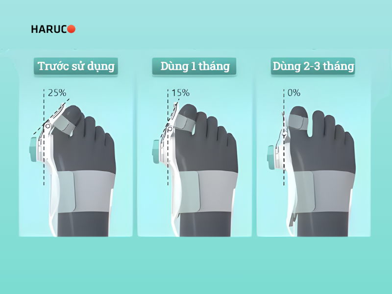 nep-ngon-chan-cai-haruco