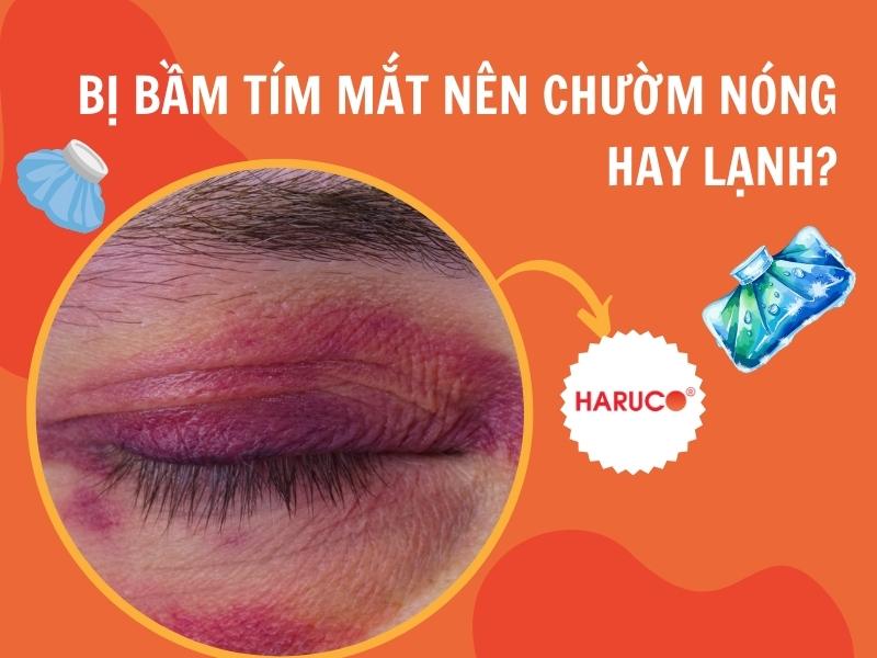 Bị bầm tím mắt nên chườm nóng hay lạnh? Cách chườm đúng