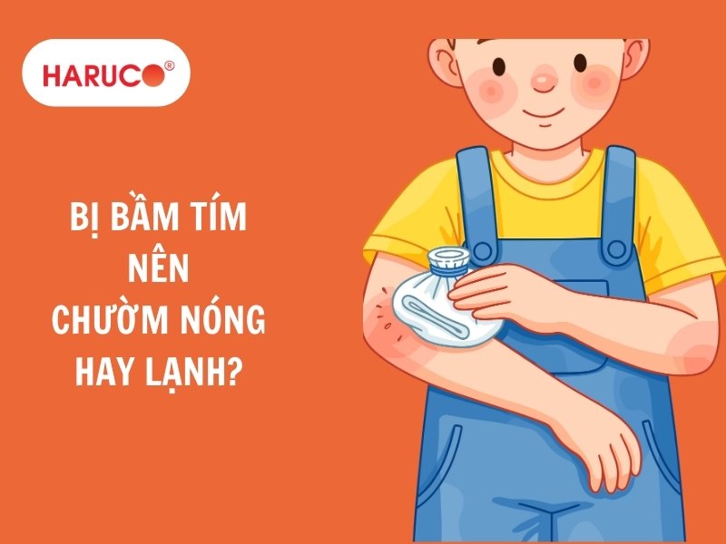 Bị bầm tím nên chườm nóng hay lạnh giúp tan máu bầm nhanh?