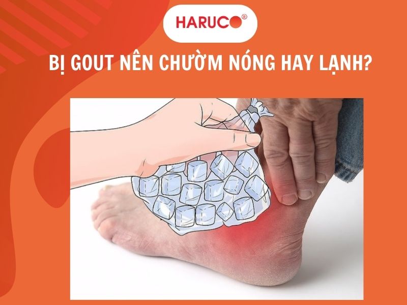 Bị gout nên chườm nóng hay lạnh? Những điều cần biết