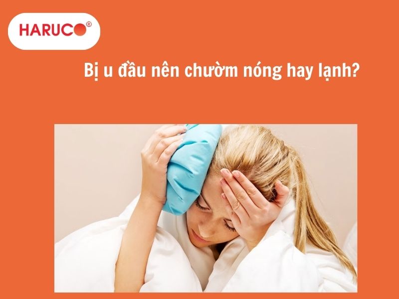 Bị u đầu nên chườm nóng hay lạnh? Những sai lầm thường gặp