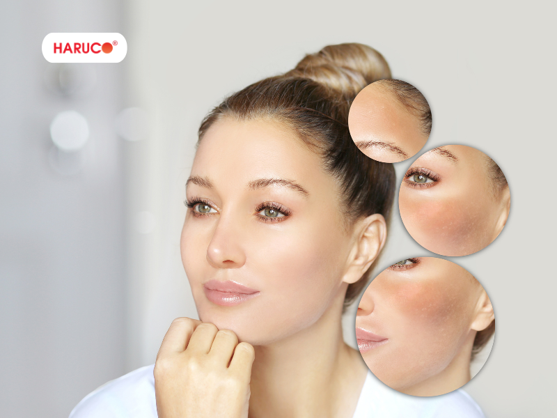 leu-xong-hoi-tai-nha-haruco