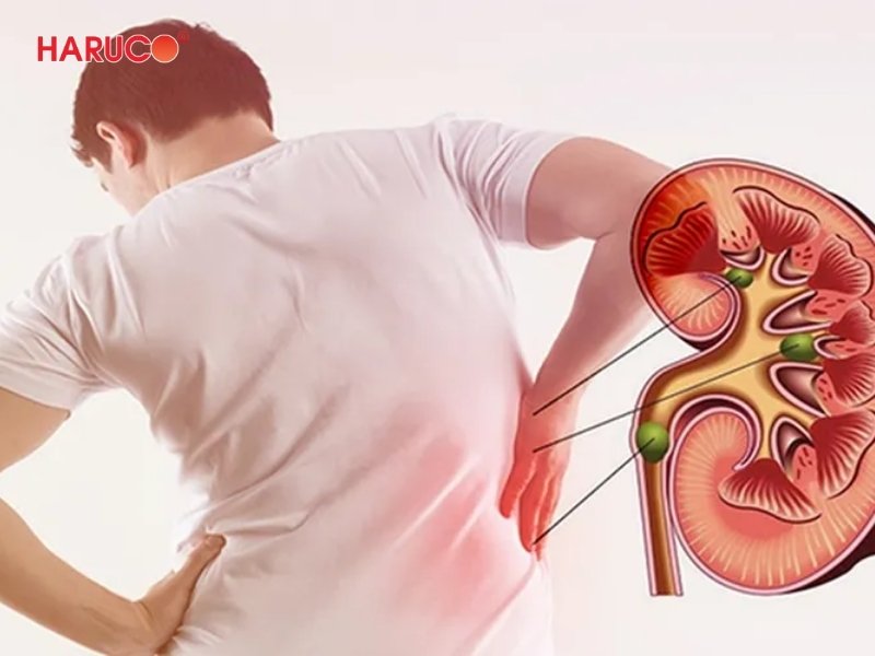 dai-gel-chuom-nong-lanh-haruco