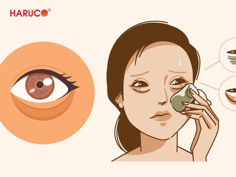 dai-gel-chuom-nong-lanh-haruco