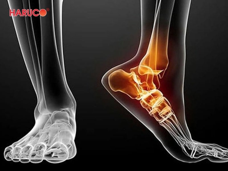 dai-gel-chuom-nong-lanh-haruco