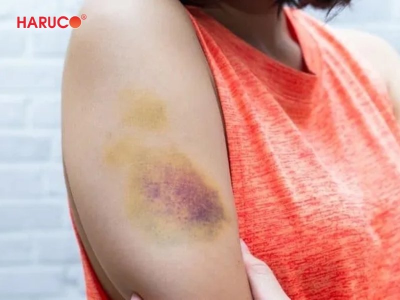 dai-gel-chuom-nong-lanh-haruco