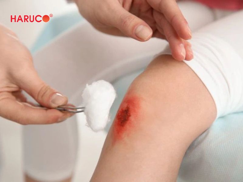 dai-gel-chuom-nong-lanh-haruco