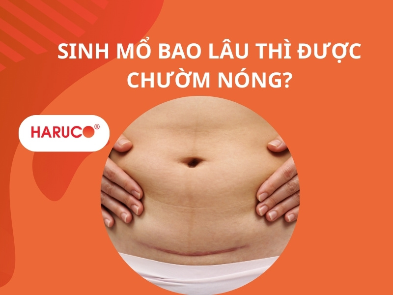 Sinh mổ bao lâu thì được chườm nóng? Cách chườm an toàn