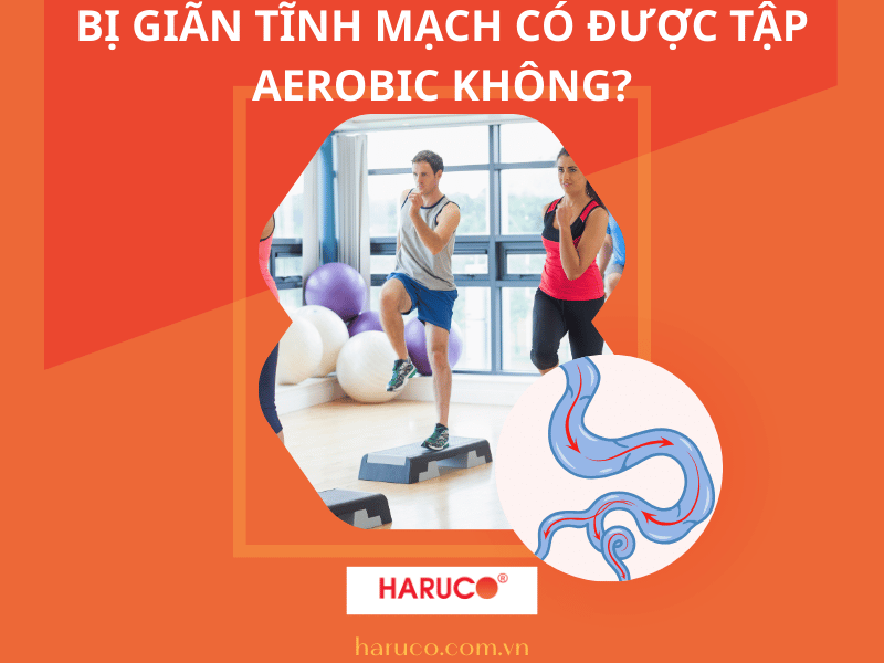 Bị giãn tĩnh mạch có được tập aerobic không?