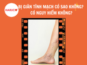 goi-ke-chan-gian-tinh-mach