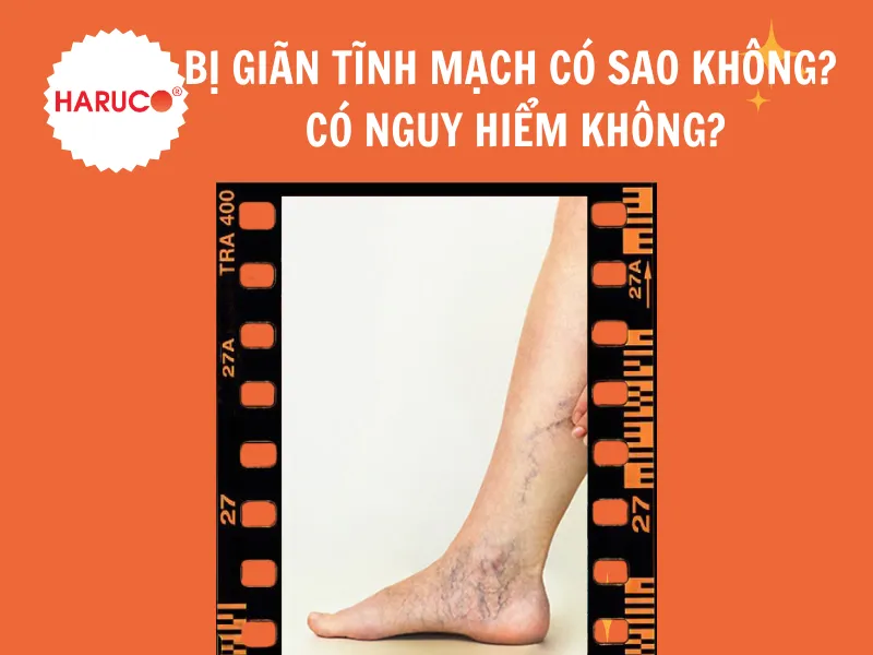 goi-ke-chan-gian-tinh-mach