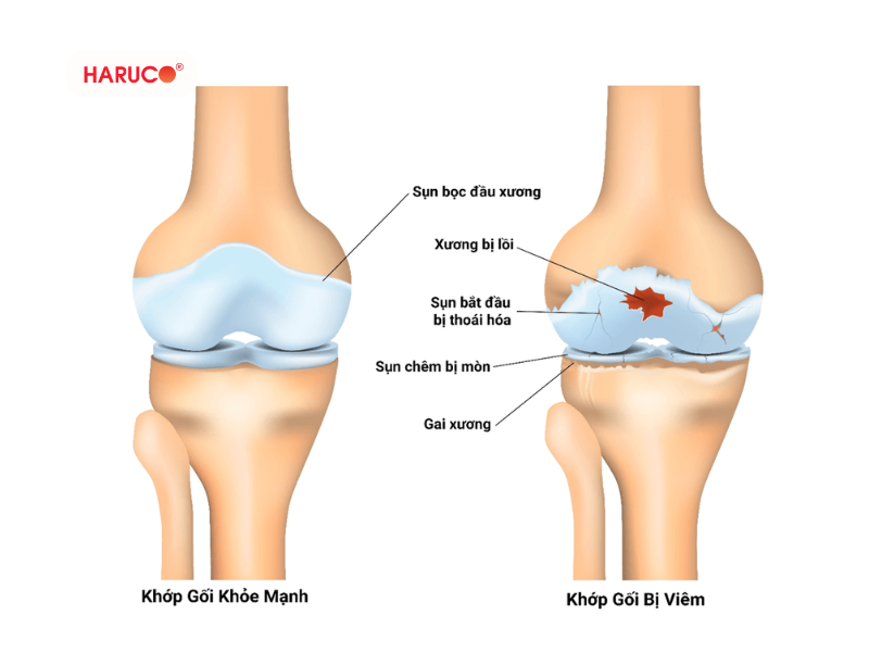 dai-bao-ve-dau-goi-haruco