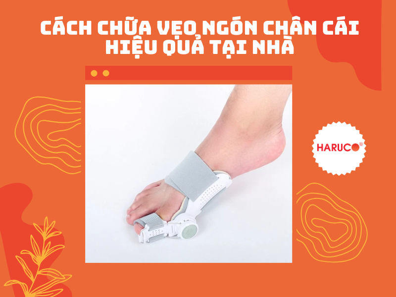 Cách chữa vẹo ngón chân cái hiệu quả tại nhà