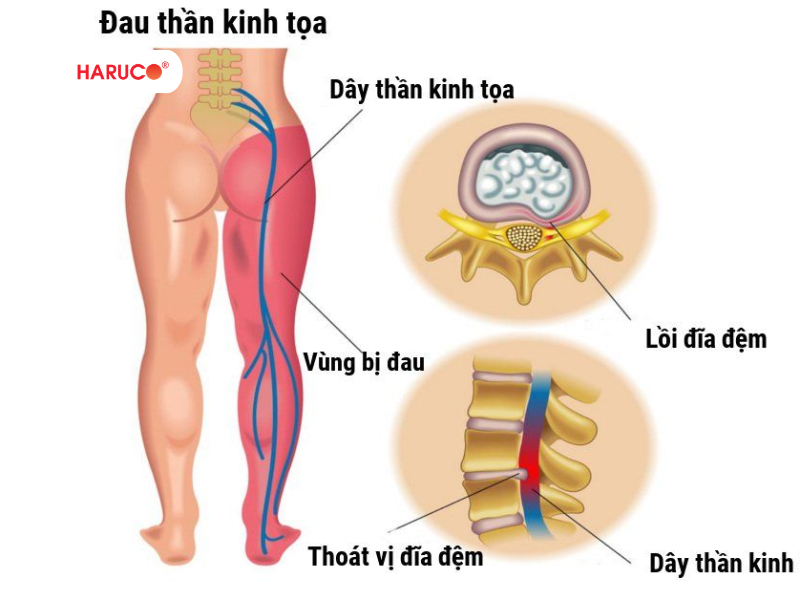 may-massage-xung-dien-haruco