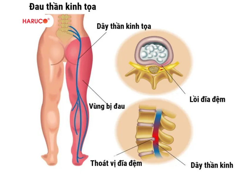 may-massage-xung-dien-haruco