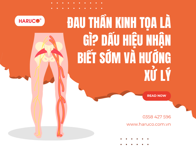 Đau thần kinh tọa là gì? Dấu hiệu nhận biết sớm và hướng xử lý