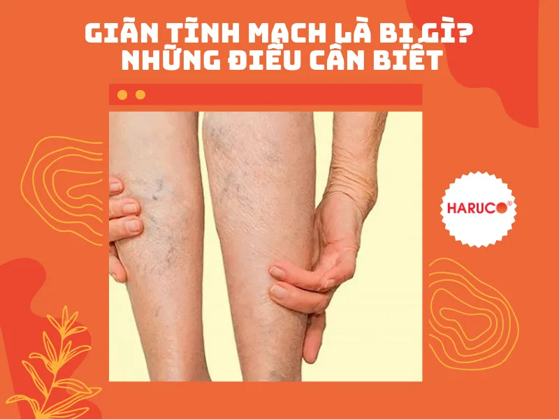 goi-ke-chan-gian-tinh-mach