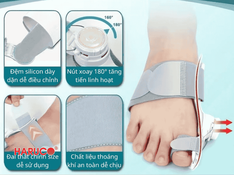 nep-chinh-hinh-ngon-chan-cai