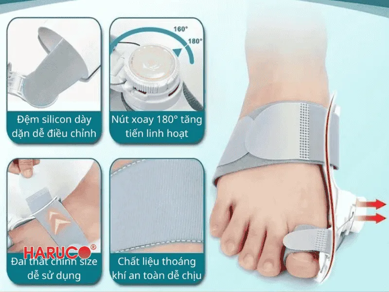 nep-chinh-hinh-ngon-chan-cai
