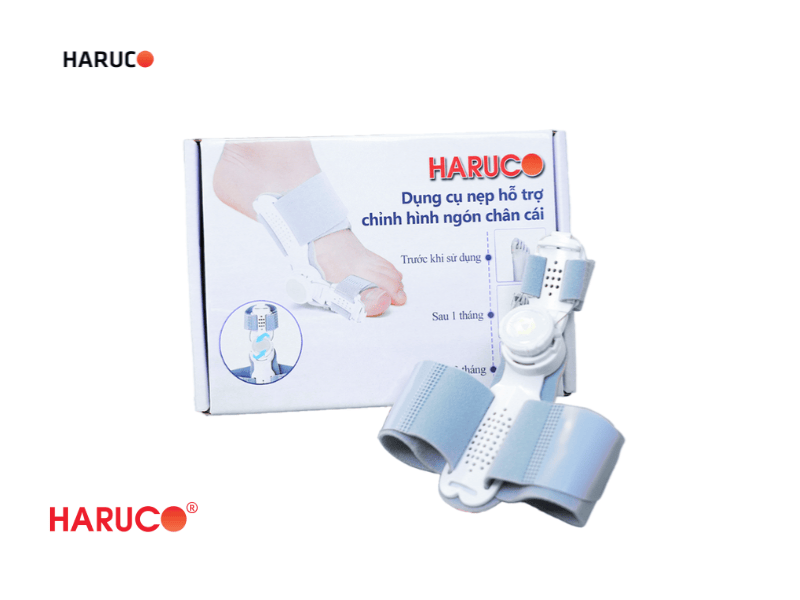 nep-chinh-hinh-ngon-chan-cai