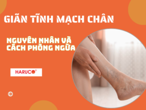 goi-ke-chan-gian-tinh-mach