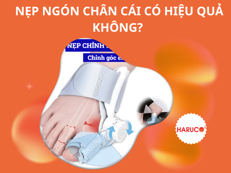 Nẹp ngón chân cái có hiệu quả không? Ưu và nhược điểm