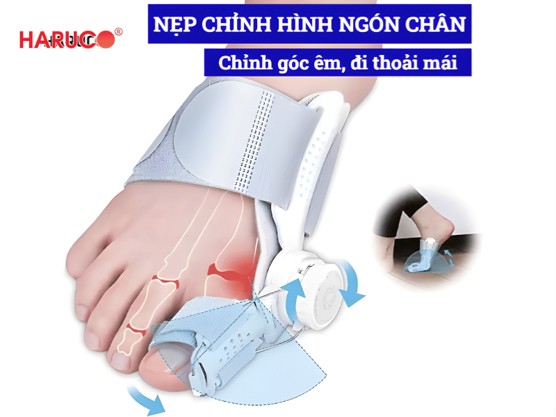 nep-chinh-hinh-ngon-chan-cai
